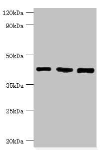 Polyclonal Rabbit anti-Human SMARCB1 / INI1 Antibody (aa86-385, IHC, WB)