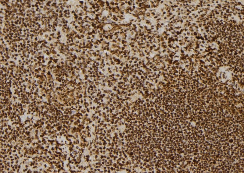 Polyclonal Rabbit anti-Human ERCC6 / CSB Antibody (IHC, WB)