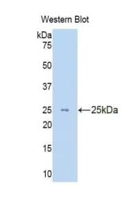 KRT8 / CK8 / Cytokeratin 8 Antibody (aa260-398)