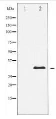 PPP1R1B / DARPP-32 Antibody