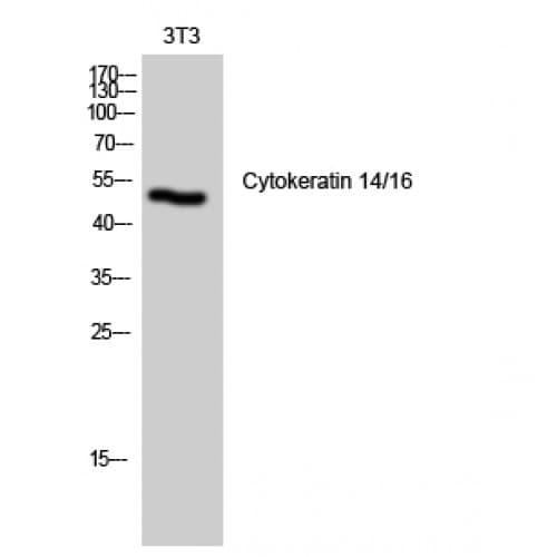 Polyclonal Rabbit anti-Human KRT14/KRT16 Antibody (1-80 aa, N-terminal, IHC, IF, WB)