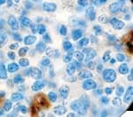 Polyclonal Rabbit anti-Human SERPINA1 / Alpha 1 Antitrypsin Antibody (IHC)