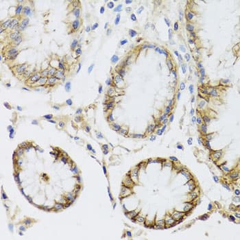 ATP1A1 Antibody