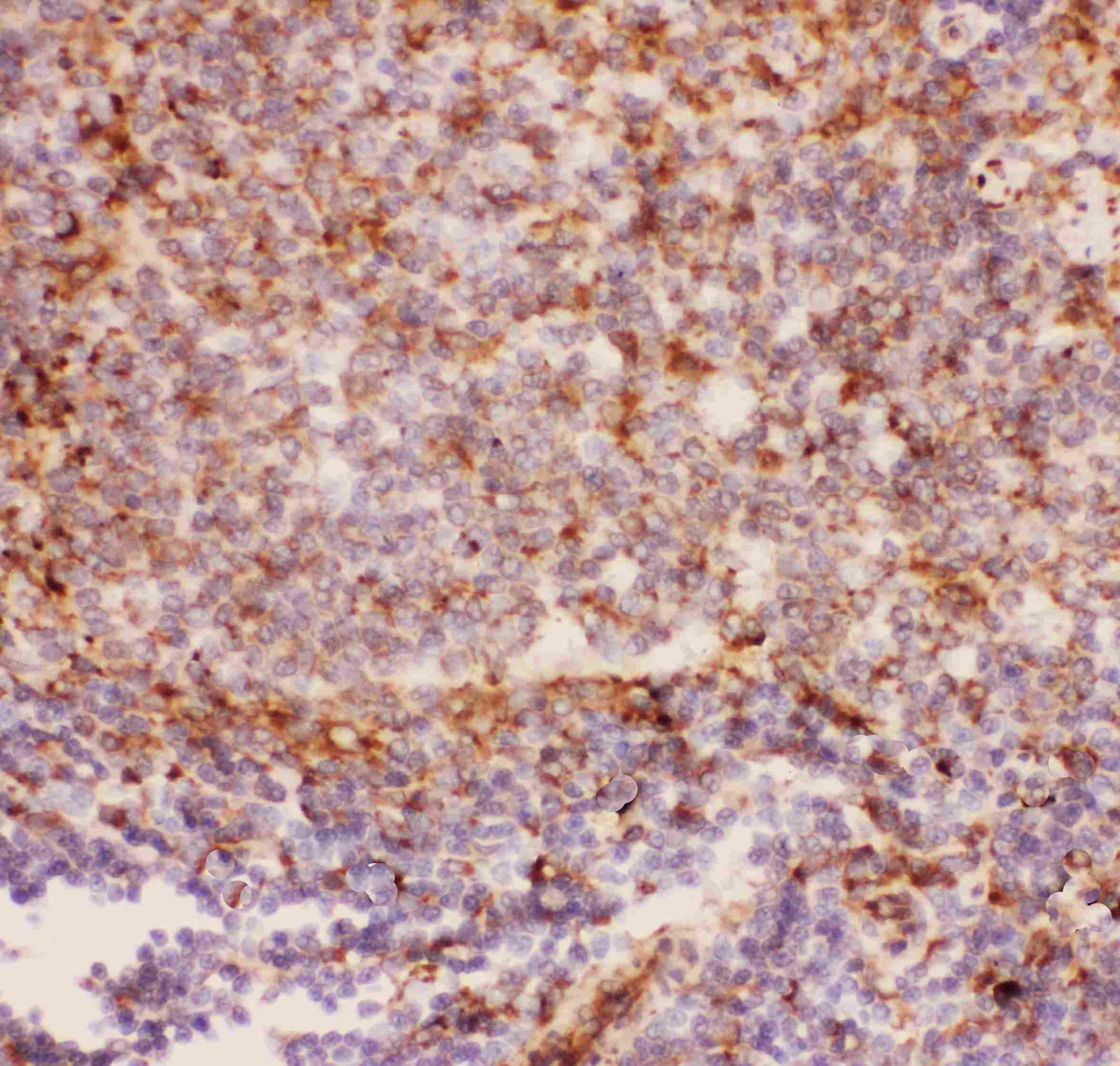 ITGAM / CD11b Antibody (aa17-382)