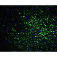 SLITRK1 Antibody