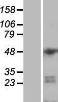 DGCR14 Protein (Over-Expression Lysate Myc-DDK (Flag))