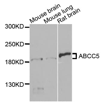 ABCC5 / MRP5 Antibody