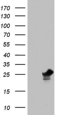 Monoclonal Mouse anti-Human PAFAH1B3 Antibody (clone OTI5D2, WB)