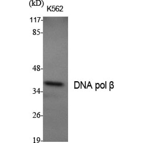 POLB / DNA Polymerase Beta Antibody (270-350 aa, C-terminal)