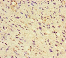Polyclonal Rabbit anti-Human GLUL / Glutamine Synthetase Antibody (IHC, IF, WB)