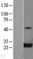 RALB Protein (Over-Expression Lysate Myc-DDK (Flag))