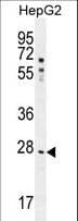 NR0B2 Antibody (aa56-83)