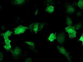 Thymidylate Kinase Antibody (clone OTI1D2)