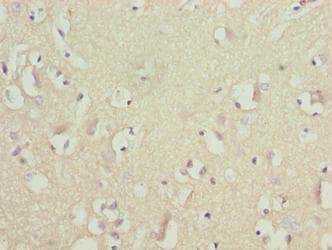 Polyclonal Rabbit anti-Human GLB1L2 Antibody (IHC)