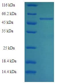 Rabbit ALDOB Protein (Recombinant His-SUMO)