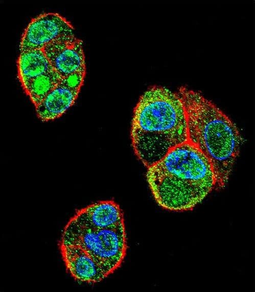 C11orf95 Antibody (aa556-584)