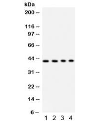 Polyclonal Rabbit anti-Human PARVA Antibody (IHC, WB)