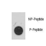 Polyclonal Rabbit anti-Human MAPKAPK2 / MAPKAP Kinase 2 Antibody (phospho-Ser272, IHC)