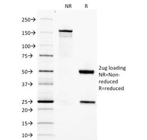 Adipokines / Adiponectin Antibody (clone ADPN/1370, Azide-free, BSA-free)