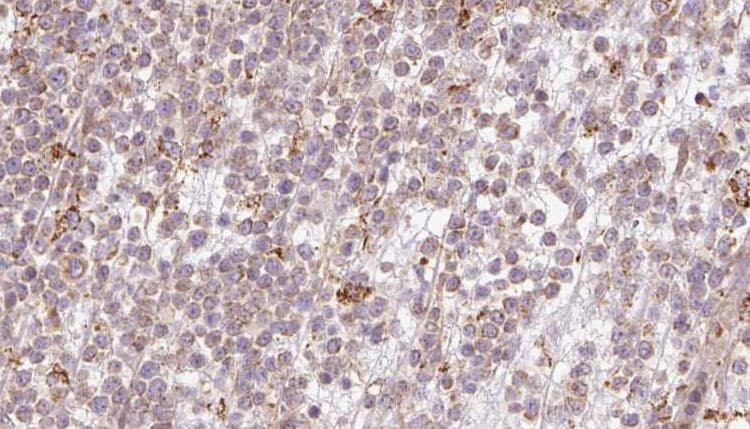 BBS10 Antibody