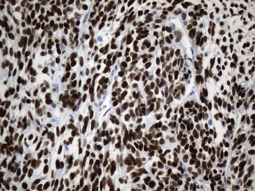 Monoclonal Mouse anti-Human TLE1 / TLE 1 Antibody (clone UMAB253, aa180-460, IHC, IF, WB)