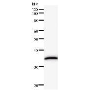RORC / ROR Gamma Antibody (clone 162C2a)