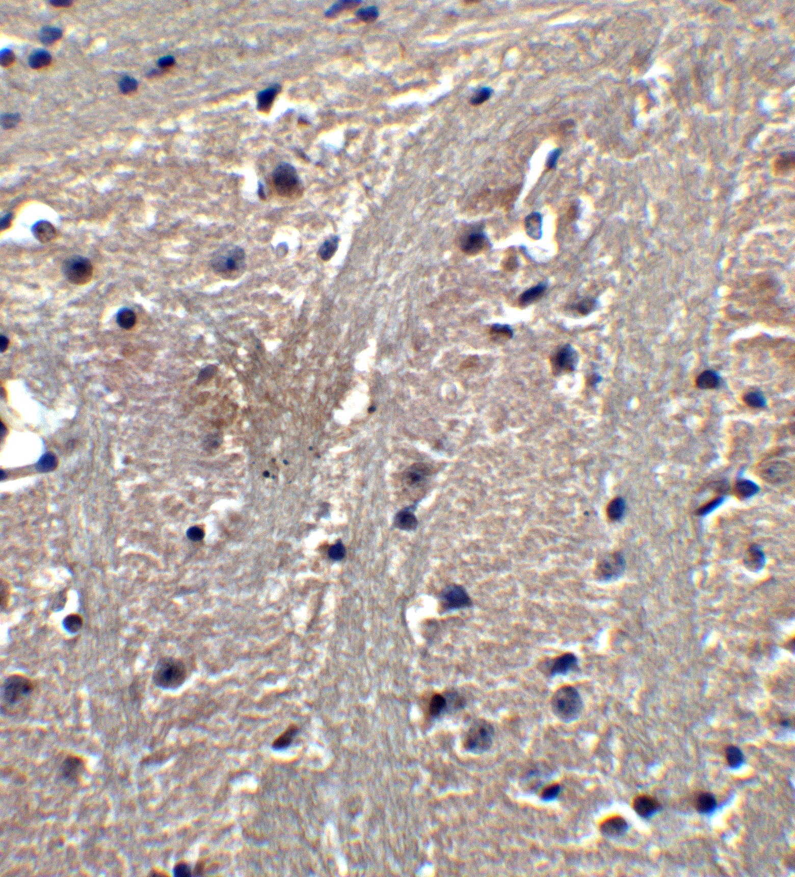 IHC-plus™ Polyclonal Rabbit anti-Human LCX / TET1 Antibody (IHC, IF, WB)