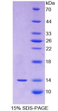 Human FGF23 Protein (Recombinant His)