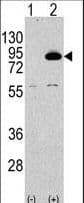 PIK3R2 / p85 Beta Antibody (aa1-30)