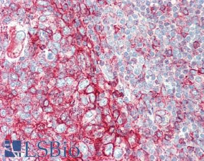 IHC-plus™ Polyclonal Rabbit anti-Human MEP1A / Meprin Alpha Antibody (aa149-175, IHC, WB)