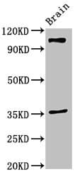 Polyclonal Rabbit anti-Human SLITRK5 Antibody (IHC, IF, WB)