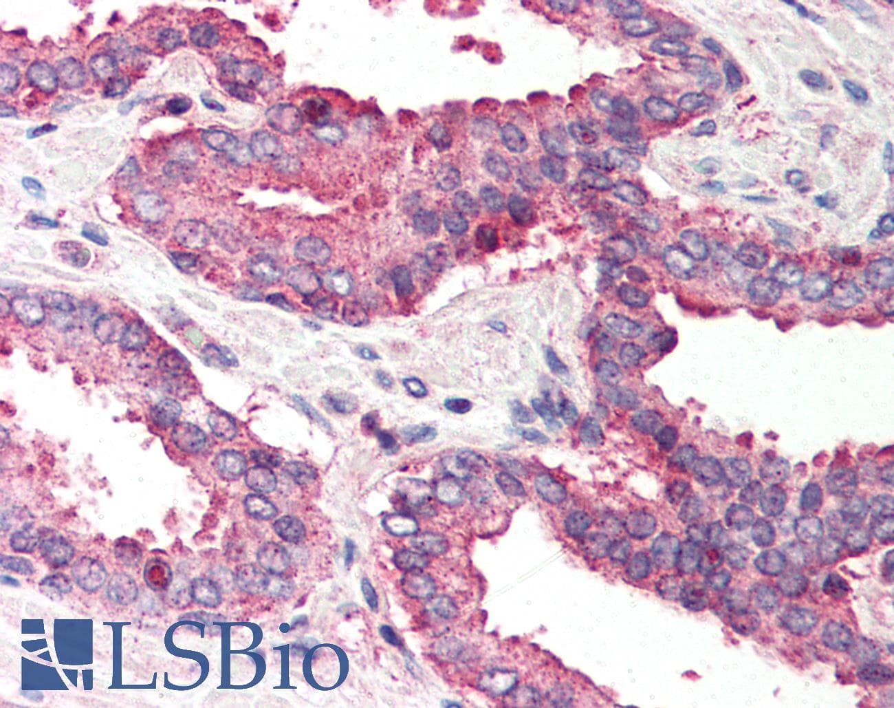 IHC-plus™ Polyclonal Rabbit anti-Human IKBKAP / IKAP Antibody (IHC, IF, WB)