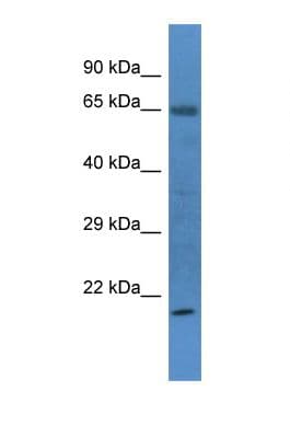 RIT1 Antibody (N-Terminus)