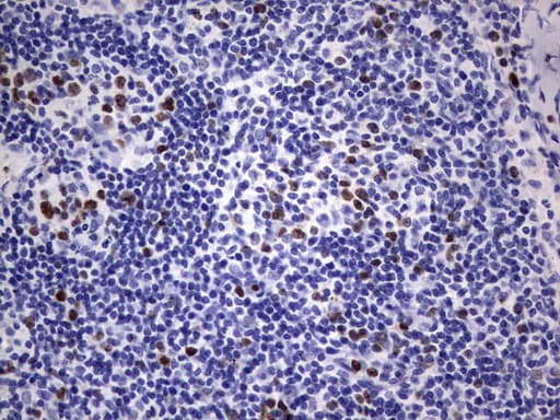 MKI67 / Ki67 Antibody (aa1160-1493, clone OTI6C12)