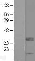 Human LRRC52 Protein (Over-Expression Lysate Myc-DDK (Flag))