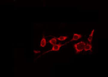 GLB1 / Beta-Galactosidase Antibody