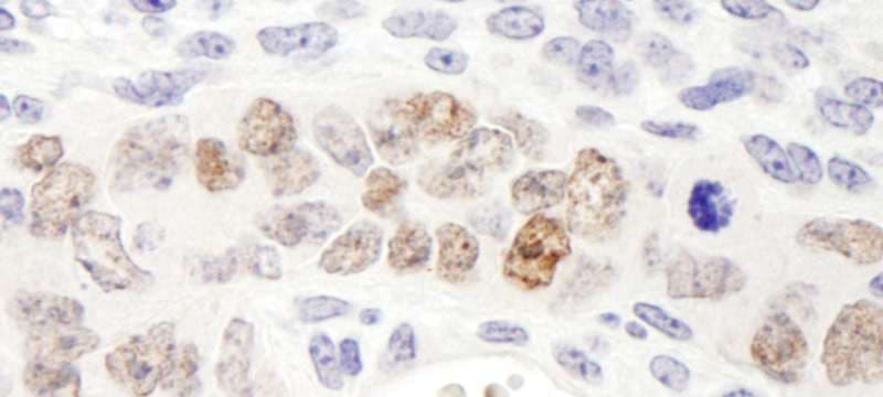 NANOG Antibody (aa1-50)