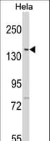 KPI-2 / LMTK2 Antibody (aa70-100)