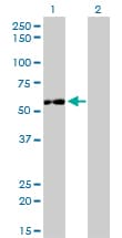 IMPDH2 Antibody (clone 1E12-B6)