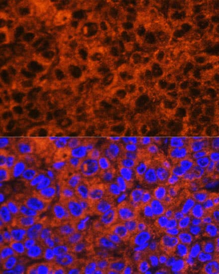 F2 / Prothrombin / Thrombin Antibody