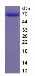 Mouse ESM1 / Endocan Protein (Recombinant His-MBP)