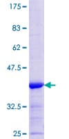 Human LAD1 Protein (Recombinant GST, N-terminus)