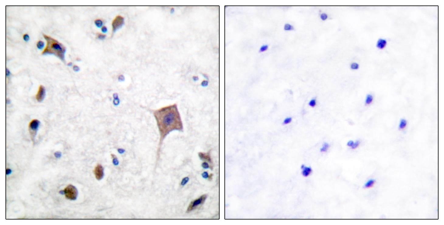 Polyclonal Rabbit anti-Human PTK2B / PYK2 Antibody (p580, IHC, WB)