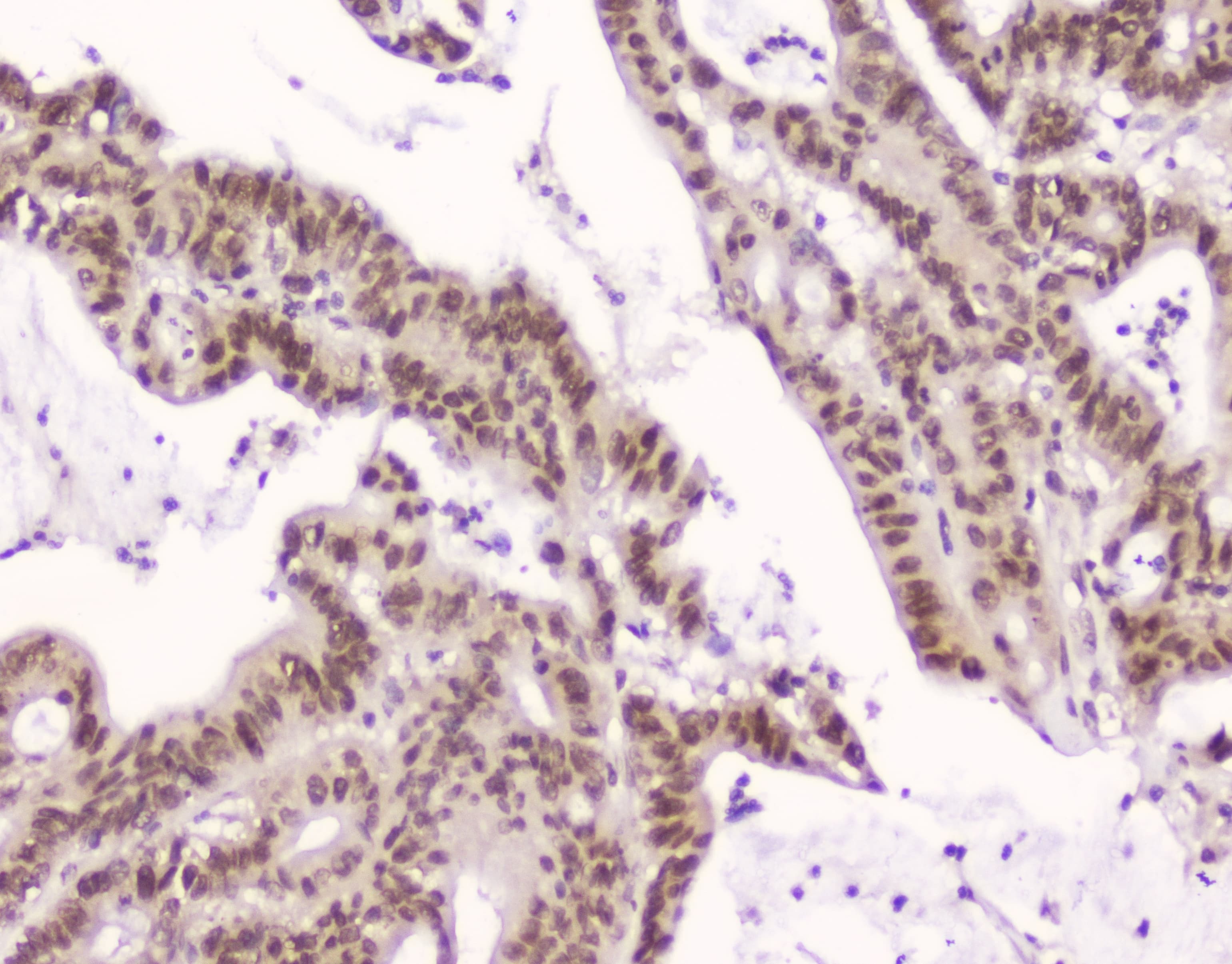 XPO1 / CRM1 Antibody