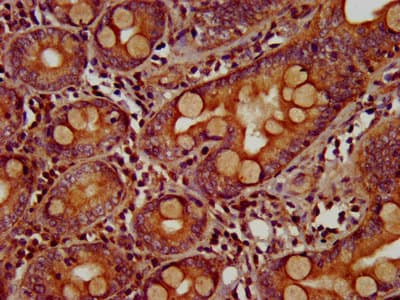 ZIC5 Antibody