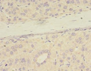 PME-1 / PPME1 Antibody (HRP)