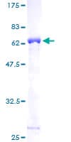 Human TPM2 Protein (Recombinant GST)