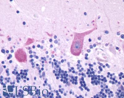 PathPlus™ Polyclonal Rabbit anti-Human GRPR Antibody (Extracellular Domain, IHC, WB)
