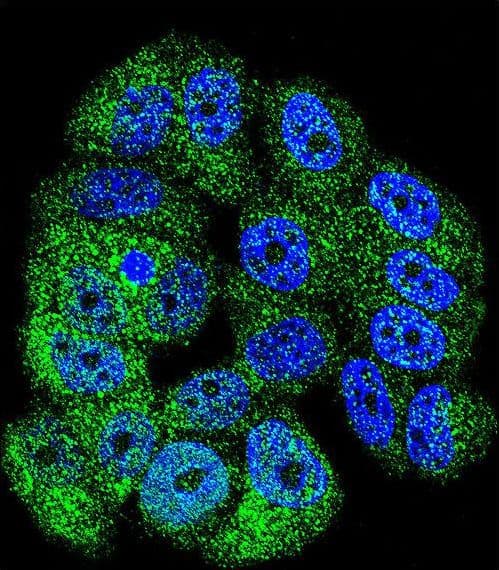 Polyclonal Rabbit anti-Human ABL1 / c-ABL Antibody (aa741-769, IHC, IF, WB)