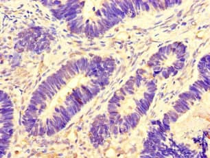 AURKA / Aurora-A Antibody (aa1-131)